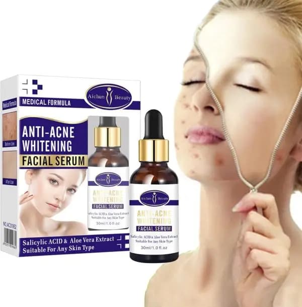 IMPORTED AICHUN BEAUTY Anti-Acne Facial Serum Aloe Vera Extract Salicylic Acid Repairs Damaged Skin 30ml